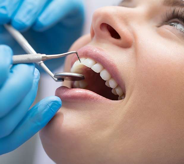 Delaware Dental Bonding