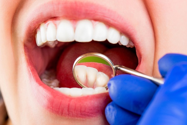 Four Benefits Of A Dental Cleaning