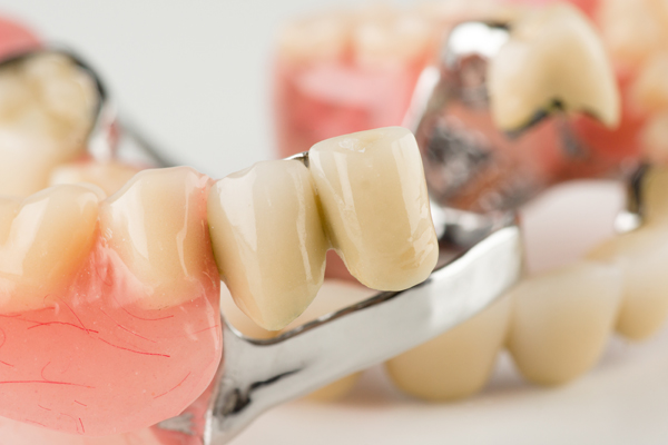 When Should I Get My Partial Dentures Repaired?